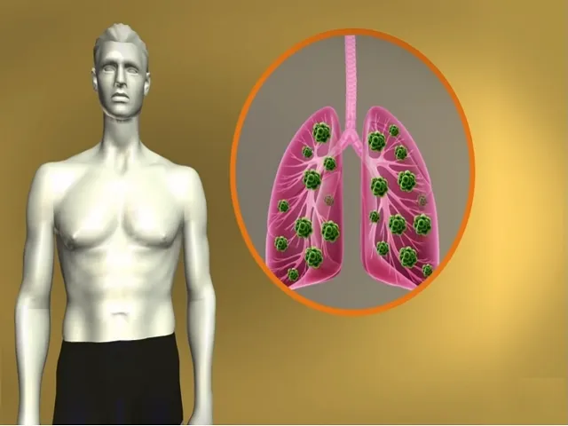 TB Patients and its lungs Photo File 640